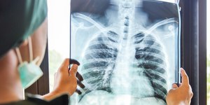 Pneumonia: o perigo para as crianças no Brasil