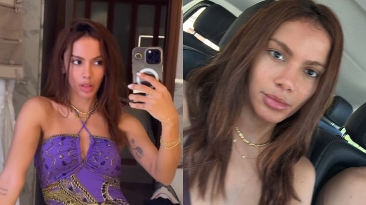 Anitta%20anuncia%20transi%C3%A7%C3%A3o%20capilar%20ap%C3%B3s%20interven%C3%A7%C3%B5es%20no%20rosto