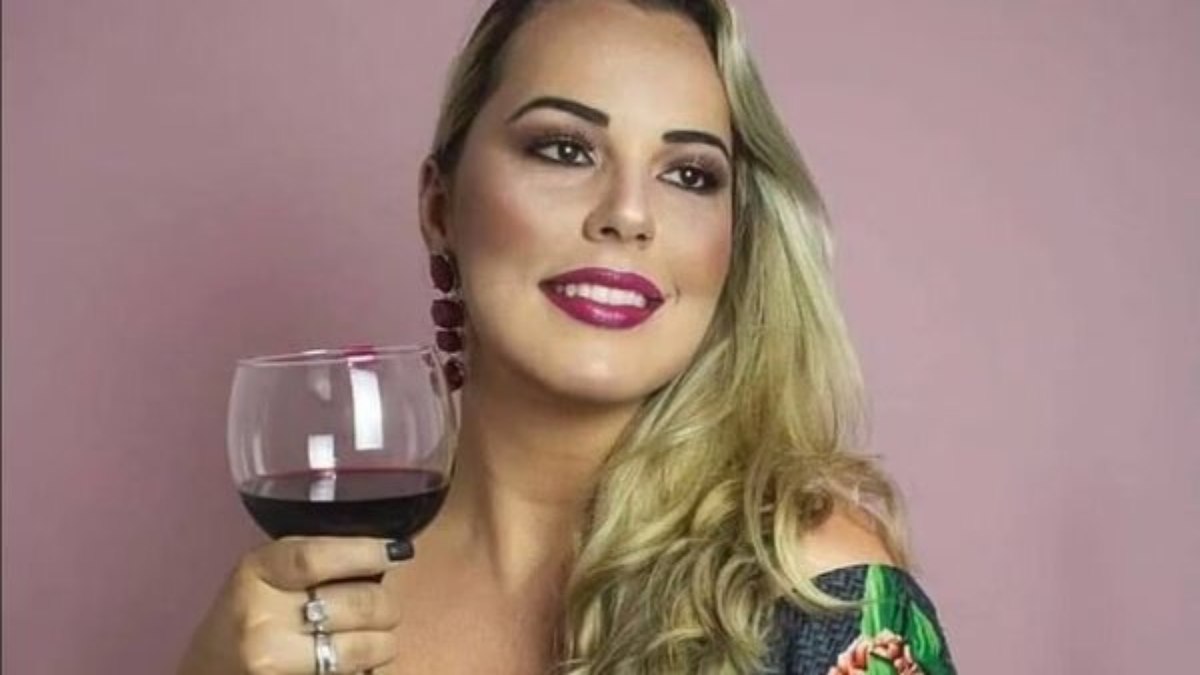 Mariana antes do procedimento com PMMA Mariana antes do procedimento com PMMA