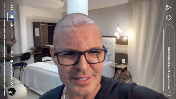 Eduardo%20Costa%20explica%20queda%20de%20cabelo%3A%20%22Usei%20muita%20bomba%22