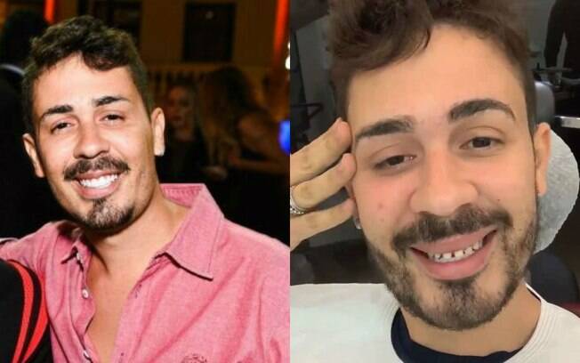 O ator Carlinhos Maia divulgou em seu Instagram algumas vezes como fica sua arcada dentária sem as lentes
