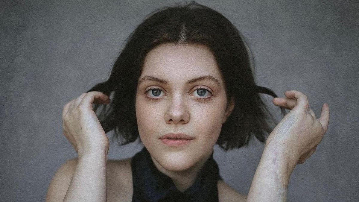 Georgie Henley se submeteu a diversas intervenções para evitar amputação do braço esquerdo