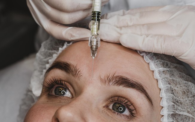 Quanto tempo é indicado esperar para retocar o botox?