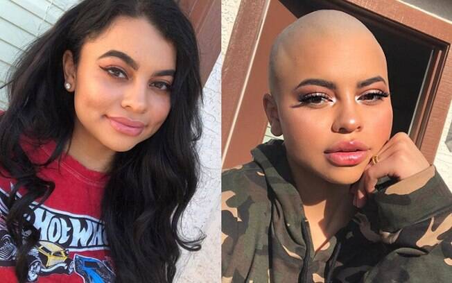 A youtuber Vanessa Martinez raspou os cabelos depois de anos utilizando a extensão capilar que a deixou careca