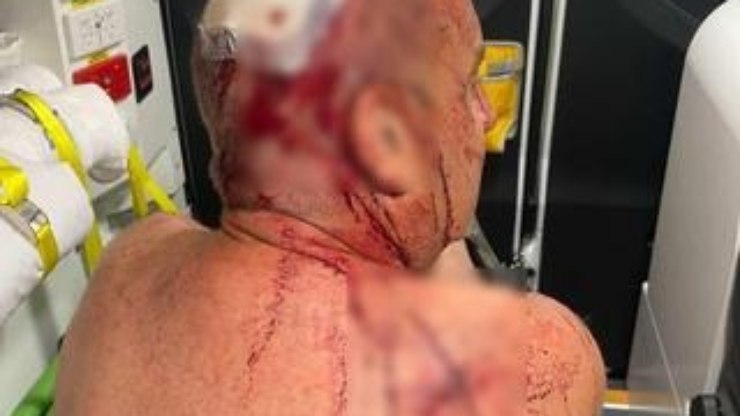 Homem tenta salvar cachorro e é espancado por canguru