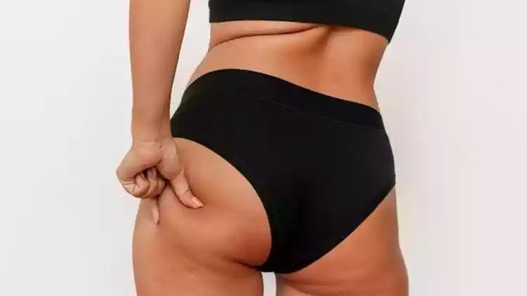 Emagreceu%20e%20engordou%3F%20O%20bumbum%20pode%20mudar%20mesmo%20assim
