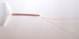 Planos de saúde terão que cobrir DIU hormonal para endometriose