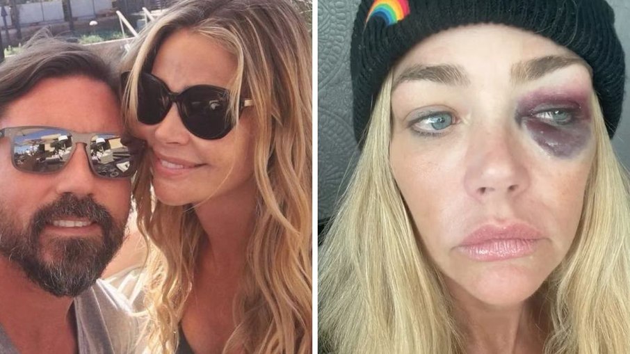 Denise Richards acusa ex-marido de agressões e pede ordem de restrição Denise Richards acusa ex-marido de agressões e pede ordem de restrição