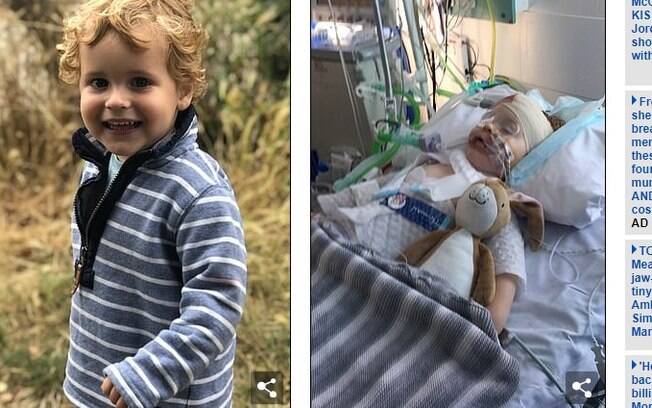 Henry, de dois anos, passou uma semana em coma induzido