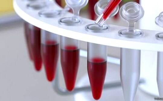 Exame de sangue detecta drogas