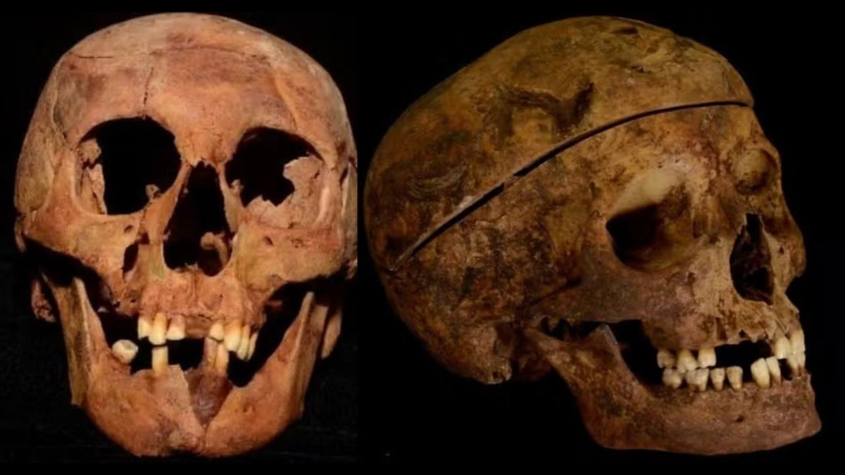 Crânios de Lampião e Maria Bonita