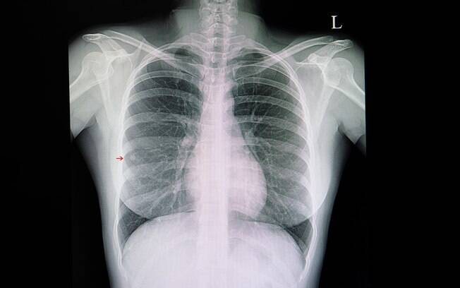 Exames de imagem em crianças as expõe à radiação, que pode ser prejudicial à saúde, alertam pediatras Exames de imagem em crianças as expõe à radiação, que pode ser prejudicial à saúde, alertam pediatras