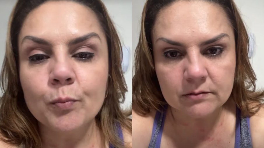 Kalilka Vólia exibiu hematomas após roubo de cordão