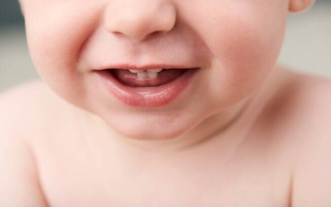 Os dentes decíduos começam a aparecer quando os bebês têm cerca de seis meses