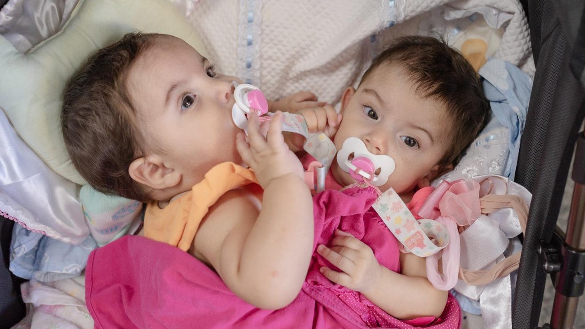 Kiraz e Aruna passaram por uma primeira cirurgia em 2024 Kiraz e Aruna passaram por uma primeira cirurgia em 2024