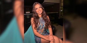 Miss apontada como affair de Amado Batista realiza rinoplastia e silicone