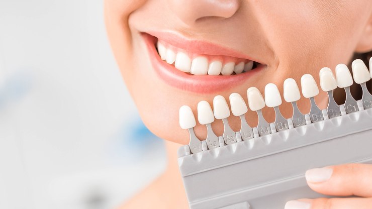 Perdi um implante dental: o que pode ter acontecido?