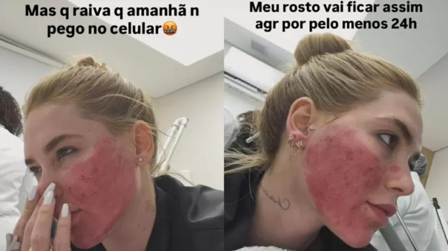 Virginia Fonseca Exibe Pele Revitalizada Após Sequência de Procedimentos Estéticos