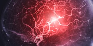 Conheça os sinais de alerta para o aneurisma cerebral