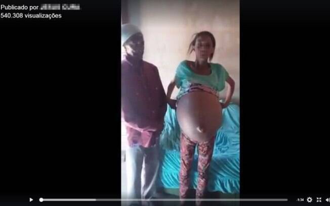 Vídeo de mulher com barriga gigante já tem mais de 500 mil visualizações e foi compartilhado diversas vezes