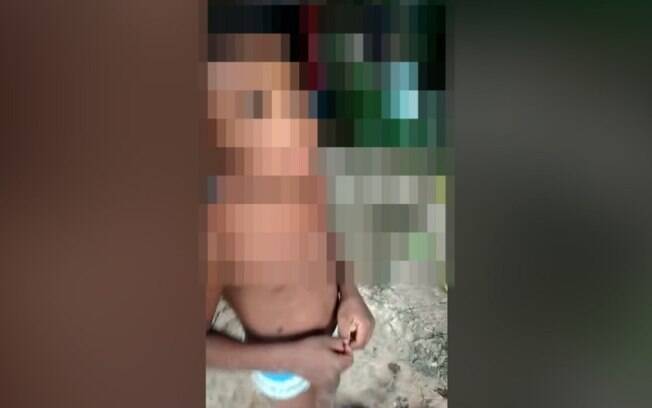 Menino de 4 anos é agredido pelo padrasto em Campinas