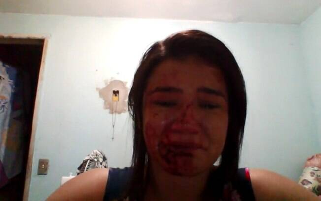 Ericka Almeida fez um vídeo onde aparece com o rosto ensanguentado após agressões