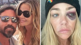 Denise Richards: quem é a atriz que denunciou o ex por agressão