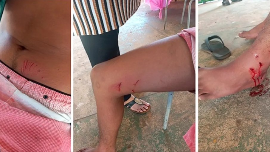 Estudante é atacado por pitbull dentro de escola no Pará