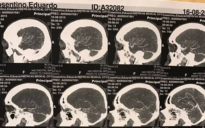 Exames enviados à Justiça pela defesa de Eduardo Cunha para atestar existência de aneurisma cerebral