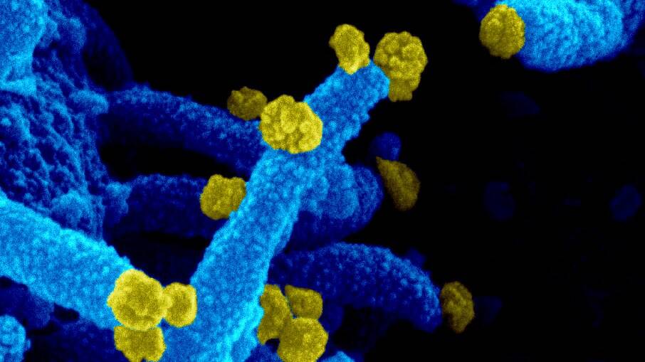 Imagem de microscópio eletrônico de varredura mostra SARS-CoV-2, o novo Coronavírus