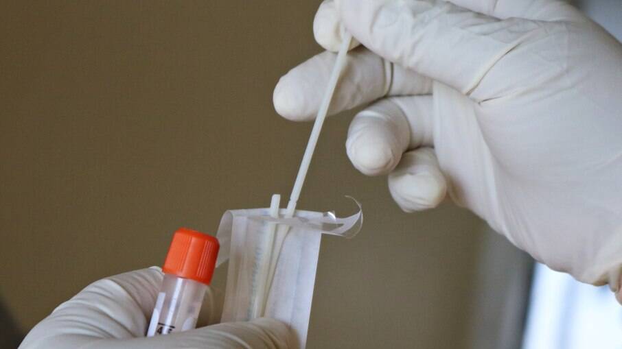 Taxa de positivos em testes RT-PCR subiu de 3% para 37% em janeiro