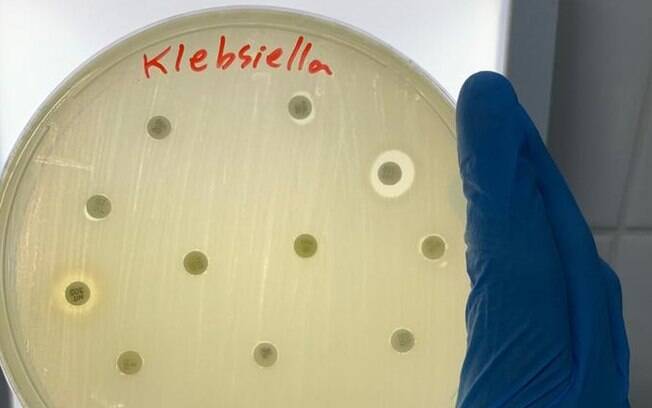 Klebsiella pneumoniae faz parte de categoria 'crítica' das bactérias contra as quais o desenvolvimento de novos remédios é mais urgente, segundo lista da OMS