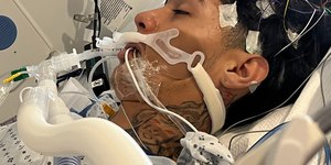 Adolescente morre após contrair rara “ameba comedora de cérebro”