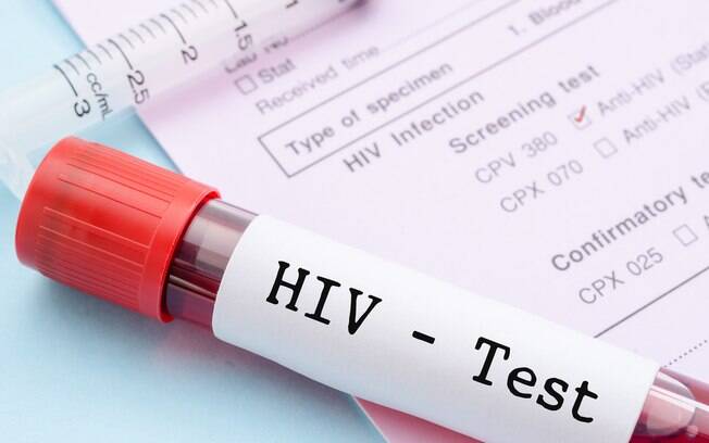 O primeiros sintomas do HIV se parecem com o de um resfriado comum, mas a maioria das pessoas infectadas não sabem