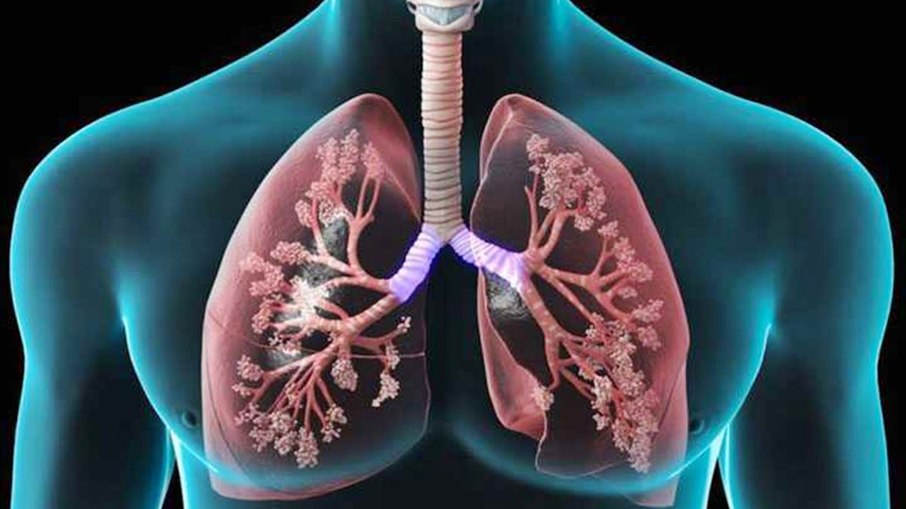 Tratamentos Respiratórios Inovadores