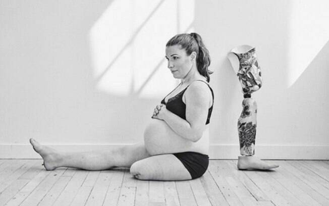 A fotógrafa Jen Squires, que tem vitiligo, fez o ensaio de maternidade de Christa, que tem uma deficiência na perna