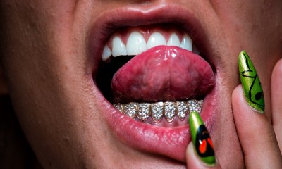 Grillz dentais: joias para os dentes que vem conquistando as celebridades