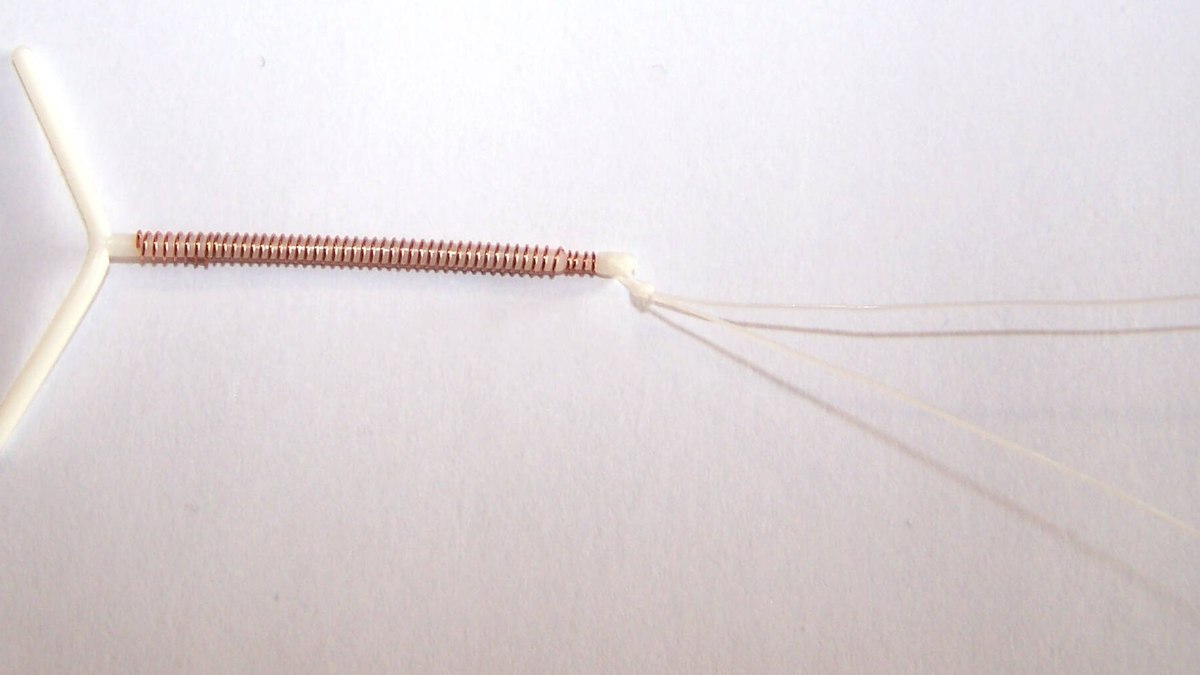 DIU, contraceptivo DIU, contraceptivo