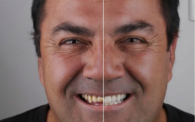 Tecnologia ajuda dentistas a prever resultados estéticos