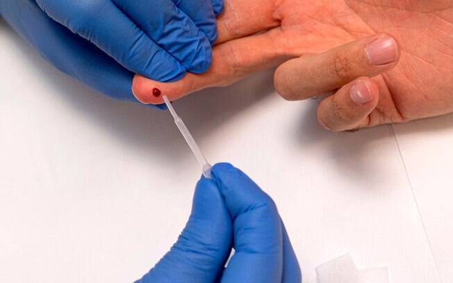 Uma pessoa tem amostra de sangue retirada como parte de um teste sorológico rápido para detectar anticorpos
