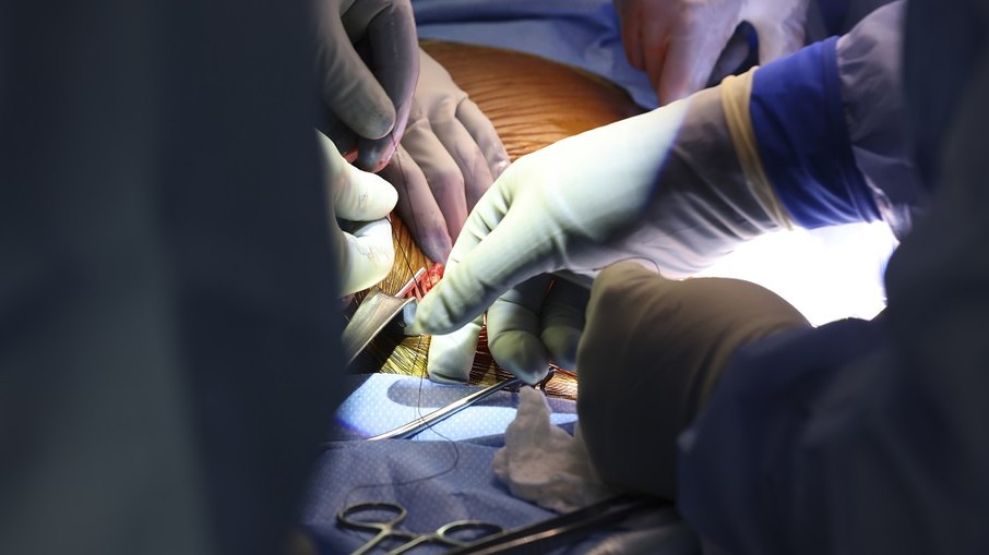 Médico brasileiro faz primeiro transplante de rim de porco para humano nos EUA
