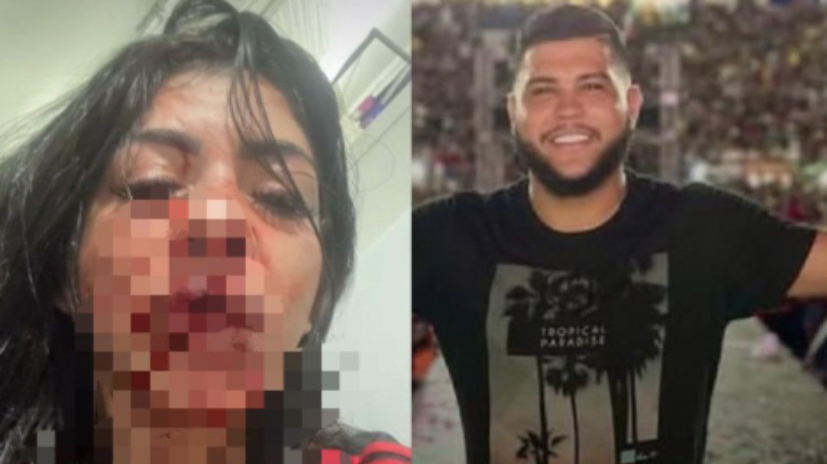 Ap%C3%B3s%20ter%20dentes%20quebrados%2C%20mulher%20retira%20a%20queixa%20contra%20cantor