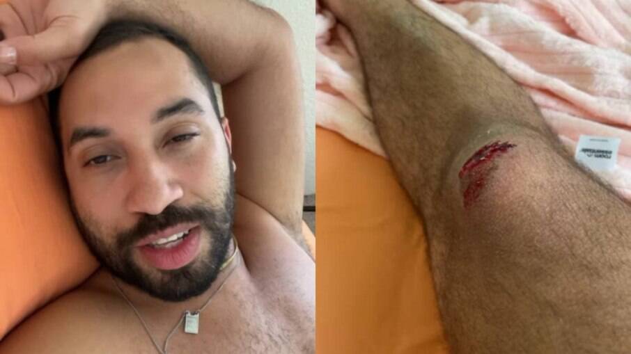 Gil do Vigor sofre acidente de bicicleta nos EUA: 'Quase desmaiei'