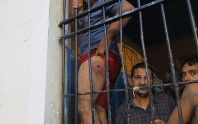 Na cadeia pública Raimundo Vidal Pessoa, preso mostra perna machucada durante chacina no Compaj