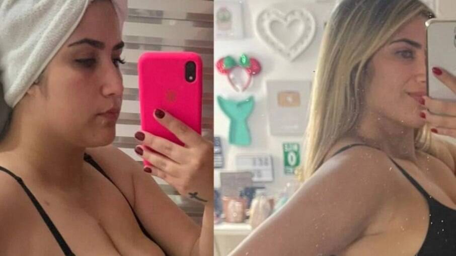 Jessica Costa perdeu mais de 20 kg após passar por cirurgia