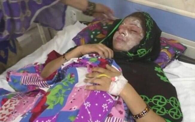Farah, de 25 anos, ficou com queimaduras graves depois de ser atacada com ácido pelo marido Siraj enquanto dormia