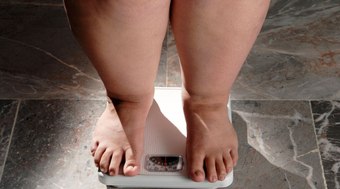 Brasil pode ser o 4º país em casos de obesidade até 2030