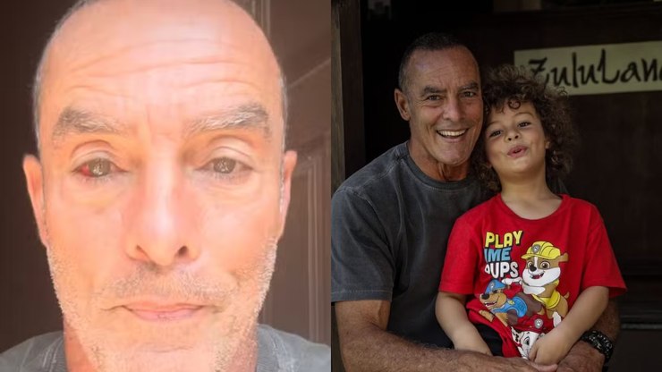 Paulo Zulu sofre derrame ocular após incidente com o filho: 