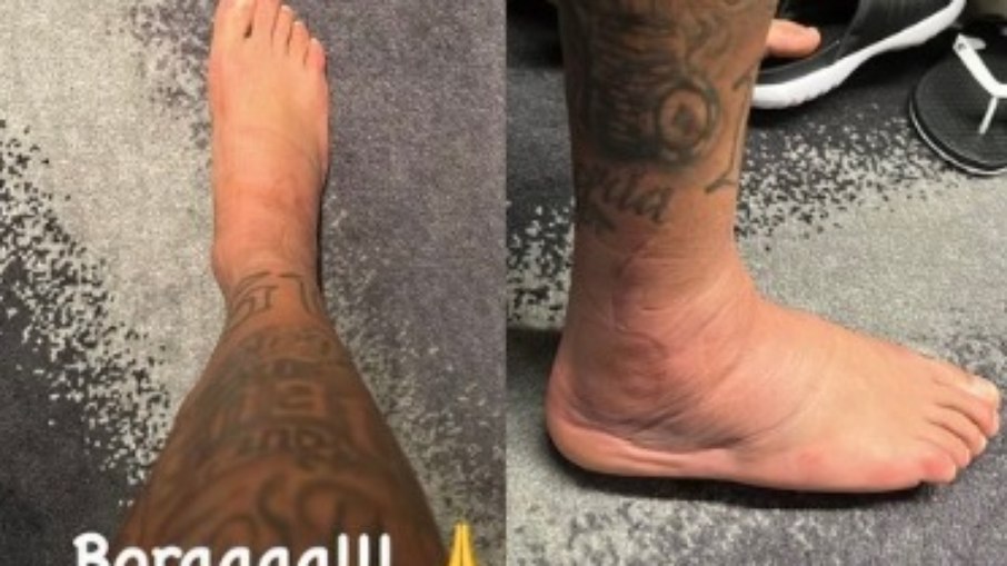 Neymar posta foto do tornozelo inchado