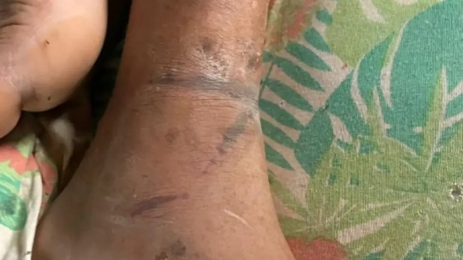 Mãe é presa após torturar e amarrar filho acamado